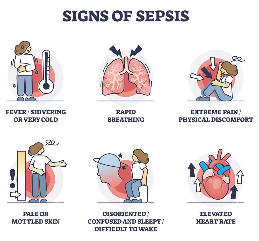 Signs-of-Sepsis-1000x930 Signs-of-Sepsis