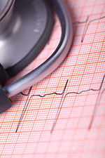 Heart-Arrhythmias